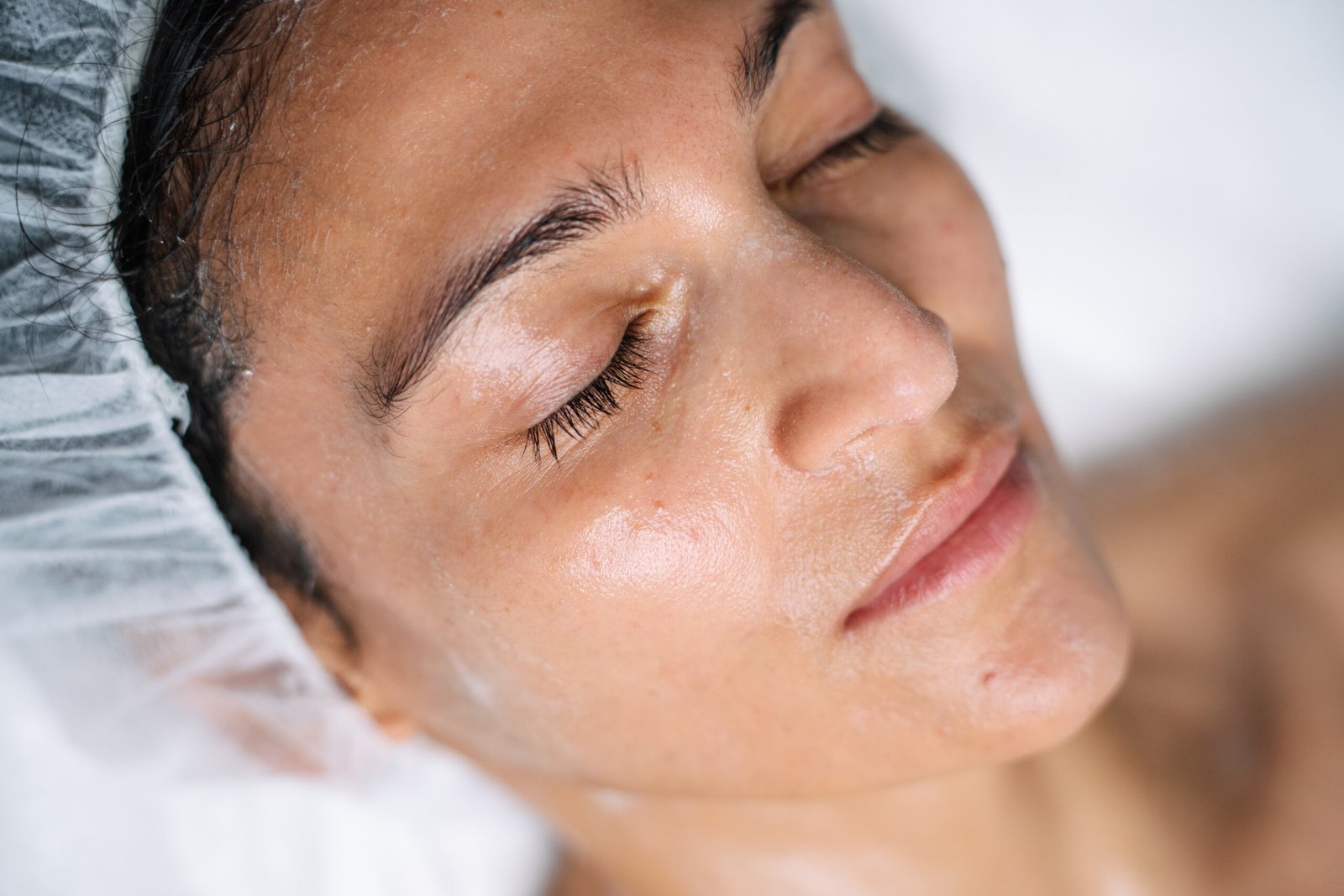 Microneedling with Serums Treatment