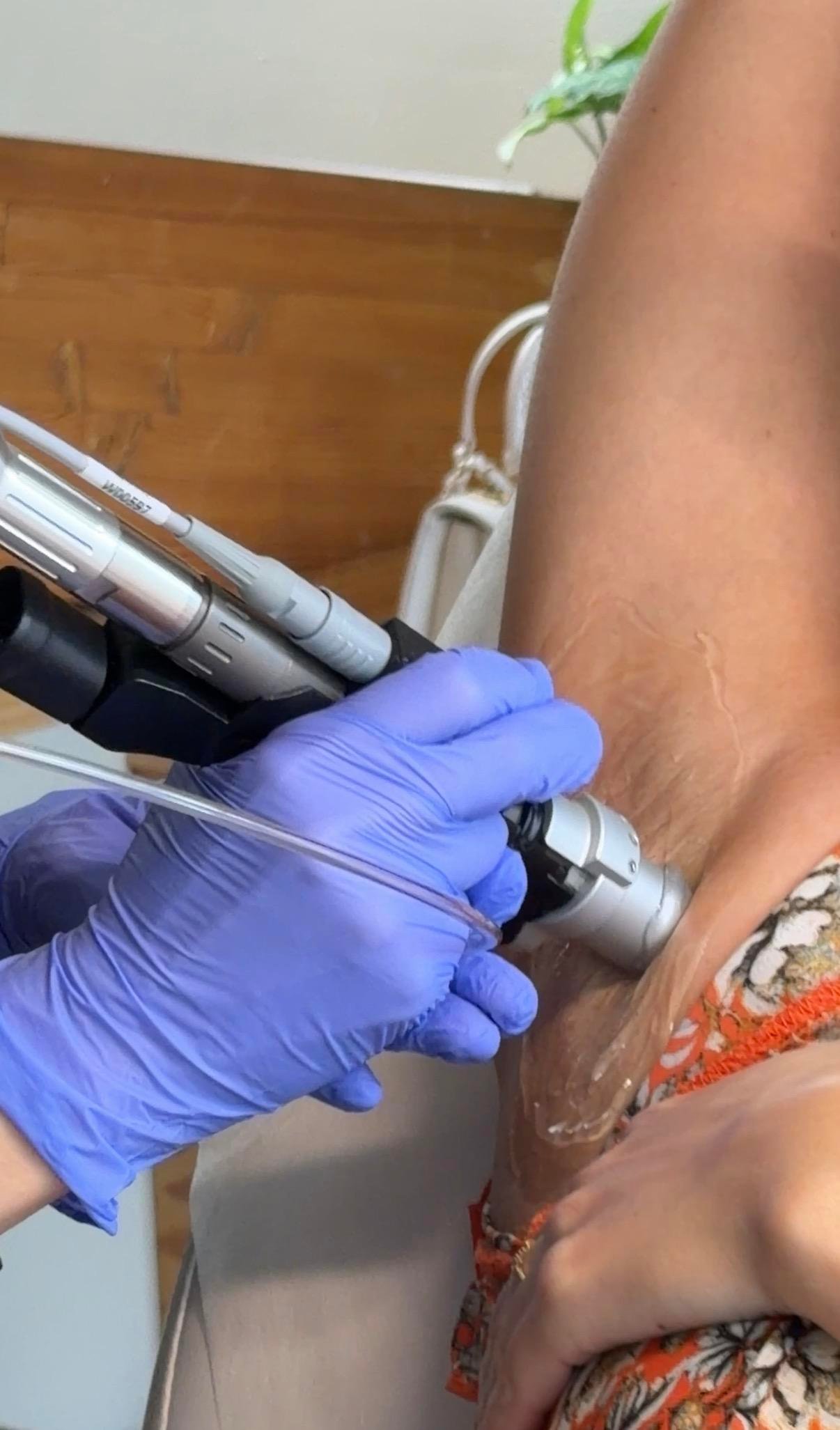 Best Laser Hair Removal