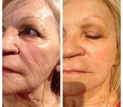 before_after_21.jpeg